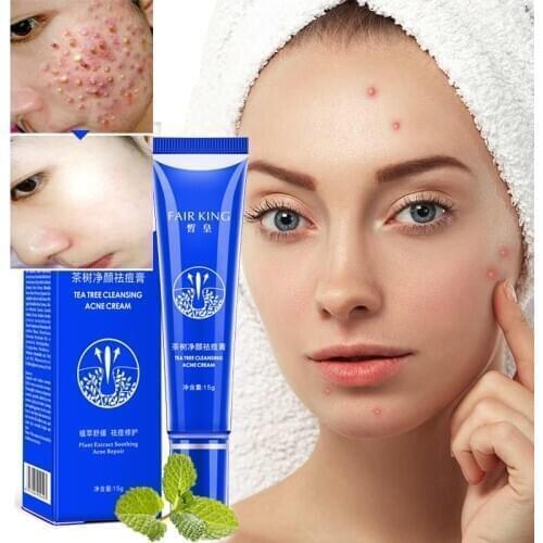 Hot sale Tea Tree Cleansing Acne Cream Face Anti Acne Marks Rough Pores Deep Cleansing Control Oil Facial Skin Care Cream 20g