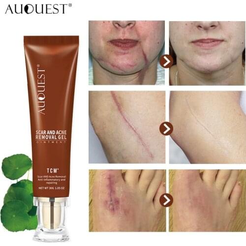 Skin Care Acne Treatment Face Cream Blackhead Repair Gel Oil Control Shrink Pores Scar Whitening Moisturizer Korean Cosmetics