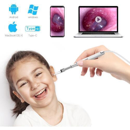 Digital Otoscope 4.3mm Visual HD Ear Scope Camera 720P Ear Cleaner Inspection Camera USB Ear Endoscope for Android Phone Mac PC