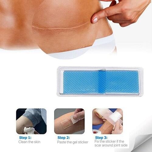 Silicone Gel Scar Away Strips Treatment Patch Scar Removal Sticker Reusable for Acne Scar Trauma Burn Sca Self-adhesiveness