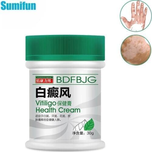 VitiligoTreament Cream 30g Antibacterial Cream Psoriasis Localized Vitiligo Ointment White Spot Mycosis Leukoplakia Treat P1153