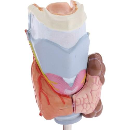 Magnified Human Thyroid Diseased Anatomy Model Teaching Supplies, Enlarged, clear view; includes attractive display stand