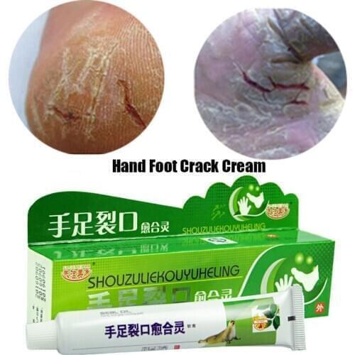 Powerful Hand Foot Crack Cream Heel Chapped Peeling Foot And Hand Repair Anti Dry Crack Skin Care Chinese Ointment