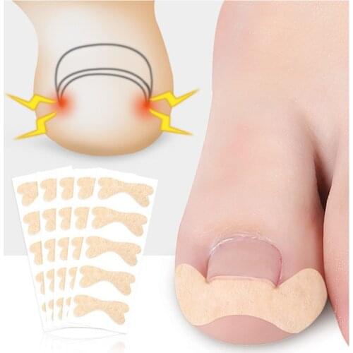 Ingrown Toenail Corrector Sticker Paronychia Treatment Recover Corrector bunion Pedicure Foot Toe Nail Care Tool