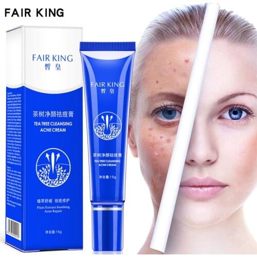 FAIR KING Acne Treatment Blackhead Removal Anti Acne Cream Oil Control Shrink Pores Acne Scar Remove Whitening Face Care TSLM2
