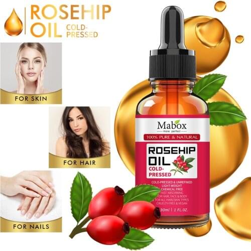 30Ml 100% New Rose Essential Oil improve skin texture fresh air reduce acne and age spot & dark spot and massage for relax body