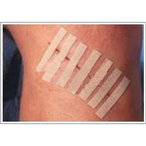 1pcs 6*100mm 12mm*100mm Scar reduction medical seam-free beauty tape surgery postpartum skin wound strip pull tight anti-speed