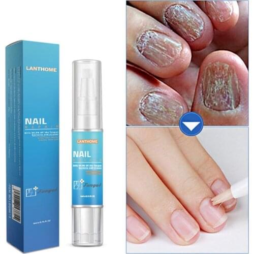 4ml Nail Repair Treatment Nail Pen Plant Essence Anti Fungal Nail Infection Toe Fungus Care Repair Serum Pen