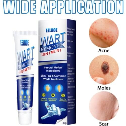 Warts Removal Cream Antibacterial Ointment Quick Effective Reduce Skin Tags Marks Clean Smooth Skin Body Cream TSLM1 TSLM1