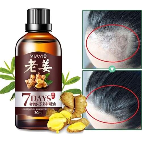 Fast Powerful Hair Growth Hair Loss Products Essential Oil Liquid Treatment Preventing Hair Loss Products 30ML TSLM1