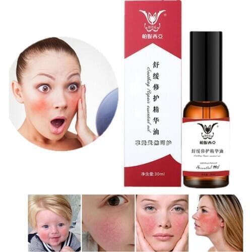 30ML Face Red Blood Silk Repair Essential Anti-Spider Vein Oil Redness Soluation Sensitive Skin Treatment Anti Aging Essence Pro
