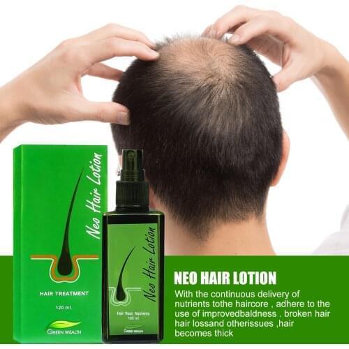 Langmanni Hair Loss Remedies
