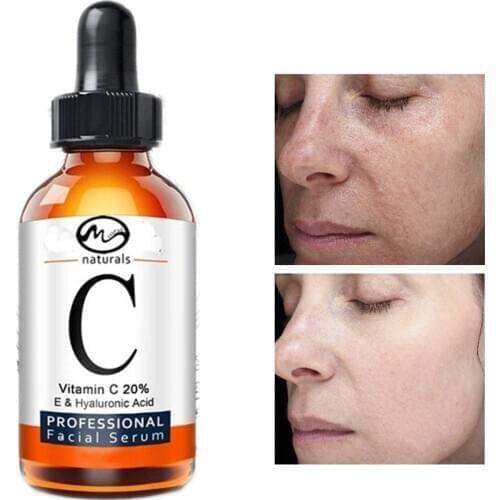 Minch 50ML 20% Vitamin C Face Serum Organic Skin Oil Hyaluronic Acid Moisturizing Anti Aging Facial Skin Care Essential Oil