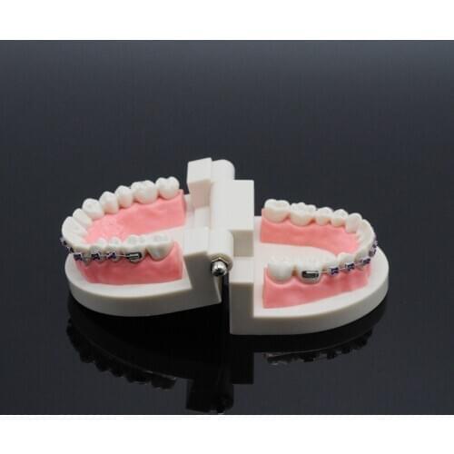 Dental Teach Study Standard Typodont Demonstration Teeth Model With Bracket For Dentistry Lab