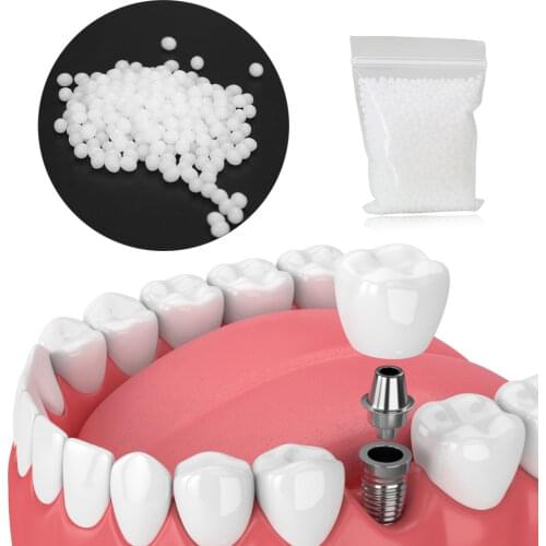 Temporary Tooth Repair Kit for Missing Broken Teeth Dental Tooth Filling Material 30g