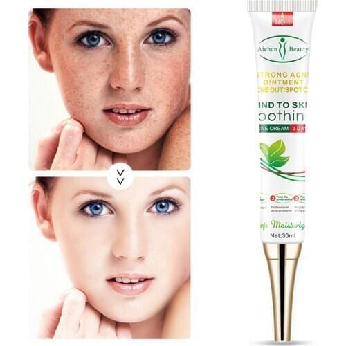 Effective Whitening Freckle Cream Remove Melasma Acne Spot Pigment Melanin Dark Spots Soothing Moisturizing Gel Skin Care