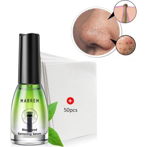 ZDAS Blackhead Strips For Face