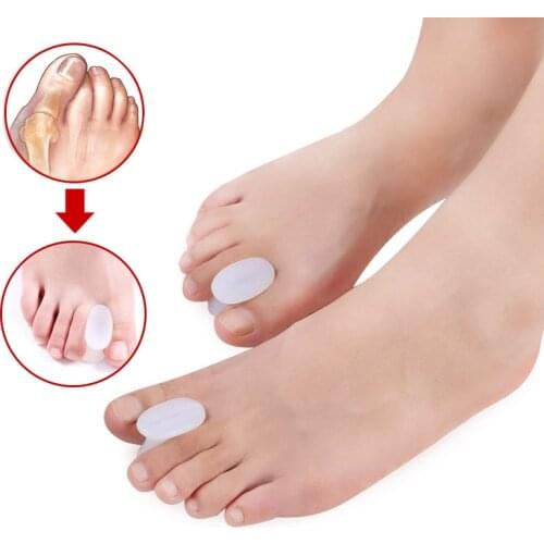 1/2Pair Finger Toes Separator Hallux Valgus Corrector Bunion Foot Tools Silicone Gel Thumb Correction Orthopedic Straightener