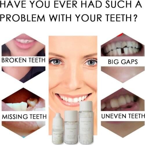 50g Temporary Tooth Filling Repair Kit Teeth Gaps Material Temp Replace Missing Teeth Repair Denture Adhesive