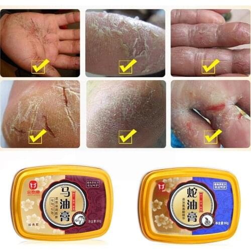 Snake Oil Hand Care Cream Horse Ointment Anti Dry Hand Nourishing Care Moisturizing Chap Antibacterial Anti Whiten Tender P5H2
