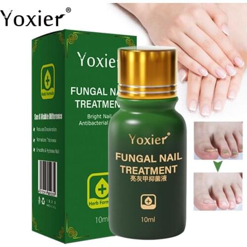 Fungal Nail Treatment Essence Antibacterial Liquid Repair Discolored Brittle Cracked Gentle Anti Infection Paronychia Nail Care