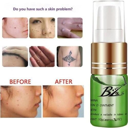 Removal ointment top eyebrow tattoo repair cream tattoo ice essence product tattoo recovery care serum skin mark 10g