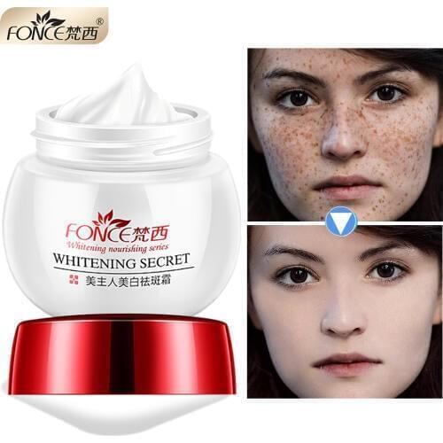 Korea Strong effect Whitening Cream Face Remove Freckles Reduces Age Spots Fade Dark Spot treatment Stain Facial Serum 30g