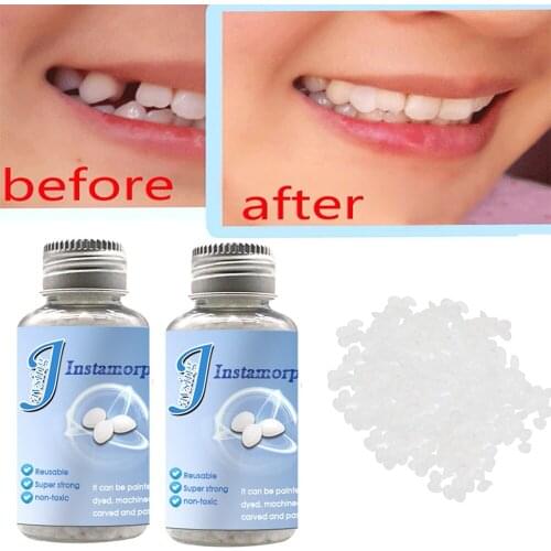 10/30ml Solid Denture Adhesive Glue Oral Cavity Temporary Tooth Filling Material Replace Missing Tooth Repair DIY Kit Oral Care