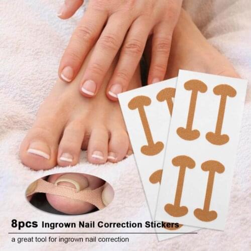 4/8pcs Professional Embedded Toe Nail Corrector Nail Treatment Elastic Patch Thumb Curl Correction Sticker Tool Care Tool