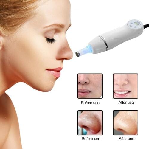 Diamond Dermabrasion Skin Peeling Beauty ,Machine Vacuum Blackhead Acne Remove Face Cleaning Facial Pore Cleaner Equipment