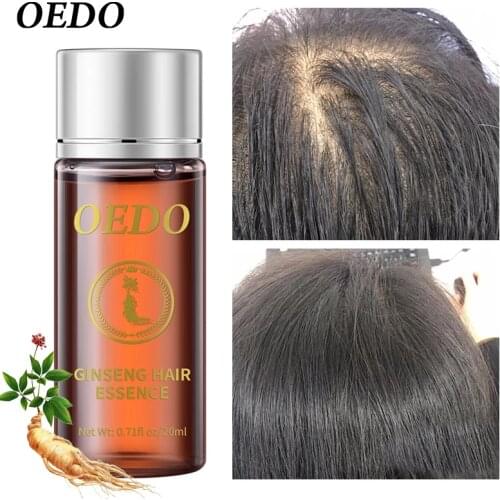 OEDO Fast Hair Growth Ginseng Essential Oil Hair Preventing Moisturize and Repair Relieve Dryness Hair Care Dry Repair