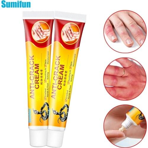 1Pcs Sumifun Anti-Chapping Repair Ointment Foot Hand Frostbite Anti-Cracking Cream Anti Itching Dry Crack Moisturizer Ointment