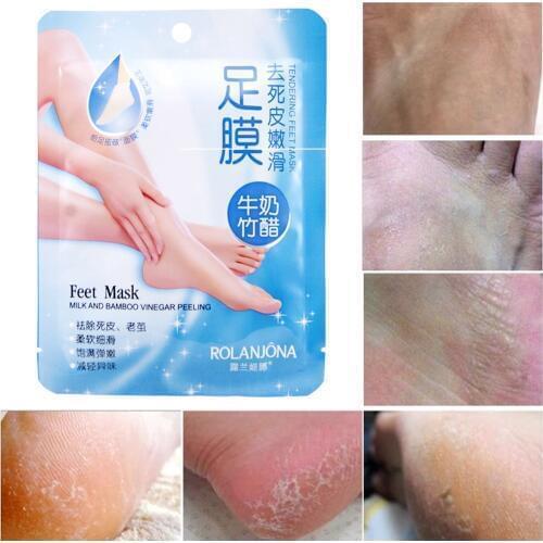 10pc=5pair Exfoliating Foot Mask Pedicure Socks Exfoliation for Feet Mask Remove Dead Skin Heels Foot Peeling Mask for Feet Care