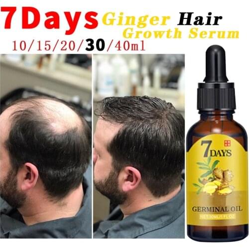 New Upated Version 7 Day Ginger Germinal Serum Essentail Oil Natural Hair Loss Treatement Effective Fast Growth Hair Care 30ML