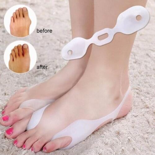 2PCS Toe Feet Valgus Hallux Bunion Orthotics Feet Care Corrector Thumb Adjuster Thumb valgus corrector Foot Care Tool