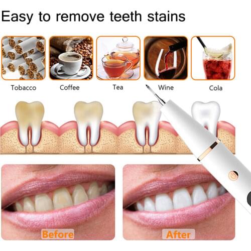 WEINONG Devices For Beauty And Health