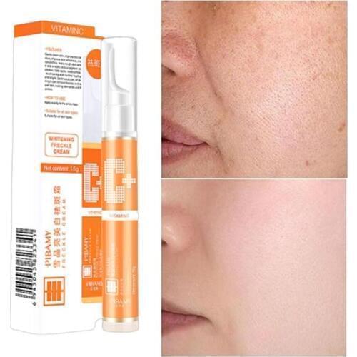 Instant Blemish Removal Gel Vitamin C Whitening Anti Freckle Cream Pen Effectively Remove the Freckle Pigmented Melanin Spots