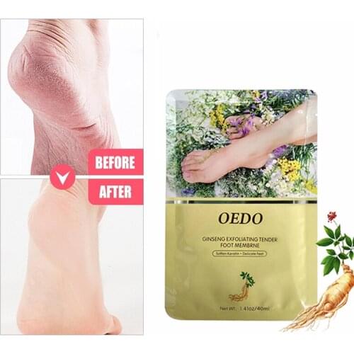 SZYDIT Exfoliating Foot Masks