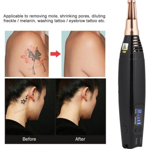 Professional Laser Picosecond Pen Blue Light Therapy Tattoo Remove Freckle Acne Mole Dark Spot Pigment Removal Machine Skin Care