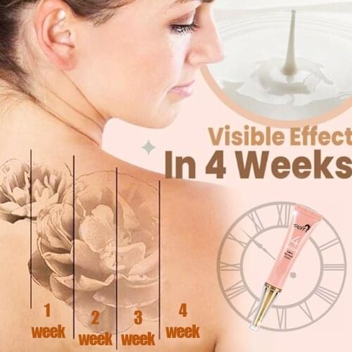Newly Permanent Tattoo Removal Cream No Need for Pain Removal Maximum Strength Pattern Tattoo Cleaning Cream