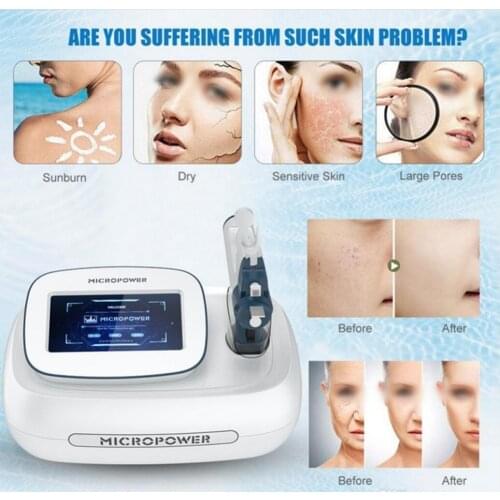 CE Approved RF Needle Free Mesotherapy Gun 3 Needle Tip For Eye Face And Body Skin Moisture Anti Wrinkle