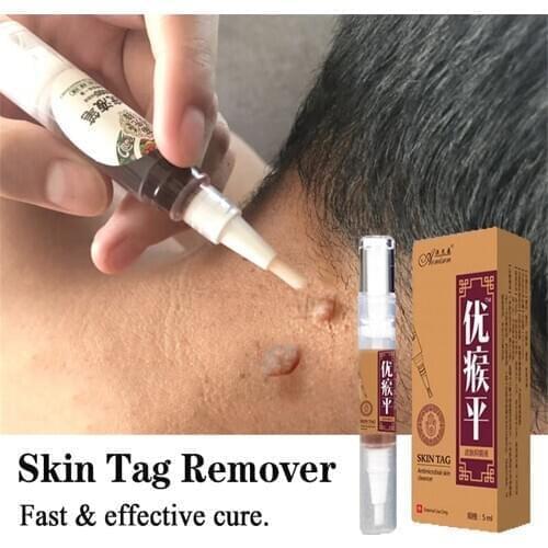 Body Skin Tag Remover Warts Treatment Pen Against Mole & Genital Plantar Wart Foot Corn Removal Papillomas Health Care Pen