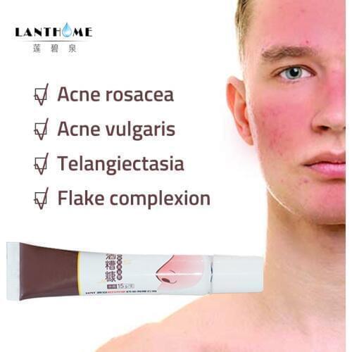 Herbal Anti Nose Mites Remove Acne Rosacea Cream Red Nose Blackhead Remover Acne Treatment Shrink Pores Products