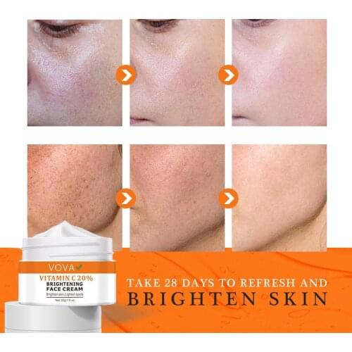 Powerful Whitening Cream To Remove Freckles Dark Sunburn Spots Face Skin Care Moisturizing Creams Beauty Cosmetic Moisturizer