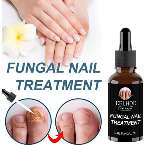 10ml/20ml/30ml/50ml Anti-Fungal Nail Care Serum Anti Onychomycosis Paronychia Nail Care Repairing Liquid Cuticle Remover