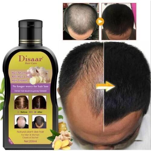 200ml Disaar Professional Anti-hair Loss Shampoo Preventing Hair Loss Chinese Hair Growth Product Hair Treatment For Men Women