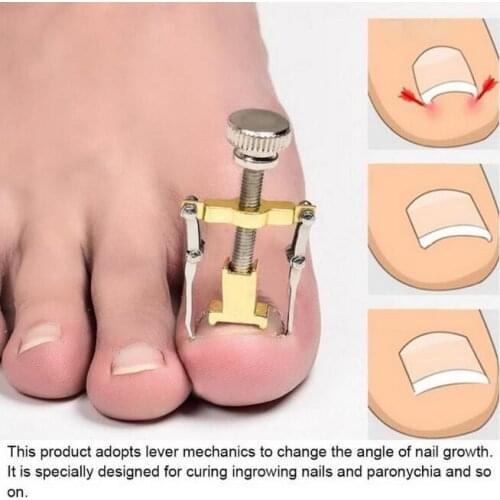 100Pcs/Lot Nail Forceps Inlay Toe Orthodontic Nail Correction Attachment Filament Groove Alloy Nail Clipper Manicure HA2222