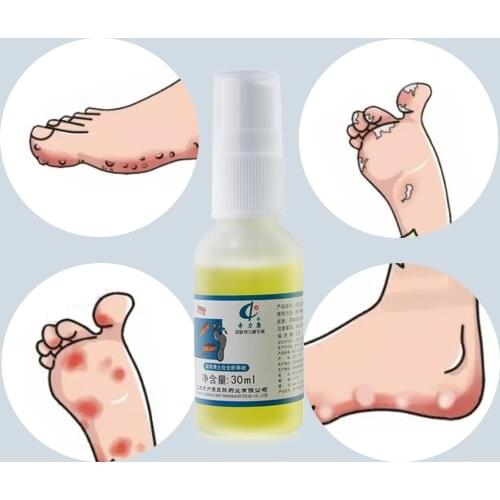 Foot Odor Spray Antibacterial Deodorant Powder Anti Itch Sweat Odor Feet Liquid Anti-fungi Spray Shoe Sock Feet Care