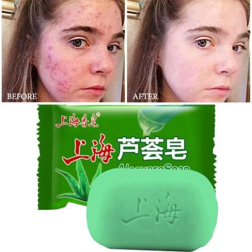 Aloe Soothing Gel Aloe Vera Gel Skin Care Remove Acne Soap Sunscreen Aloe Gel 85g Whitening Moisturizing Body and Facial Soap