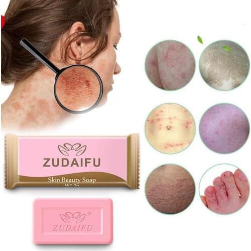 1PC Sulfur Soap Antibacterial Anti Fungus Bath Sulfur Soap Body Whitening Shampoo Soap Oil-control Acne Blackhead Treatment Soap